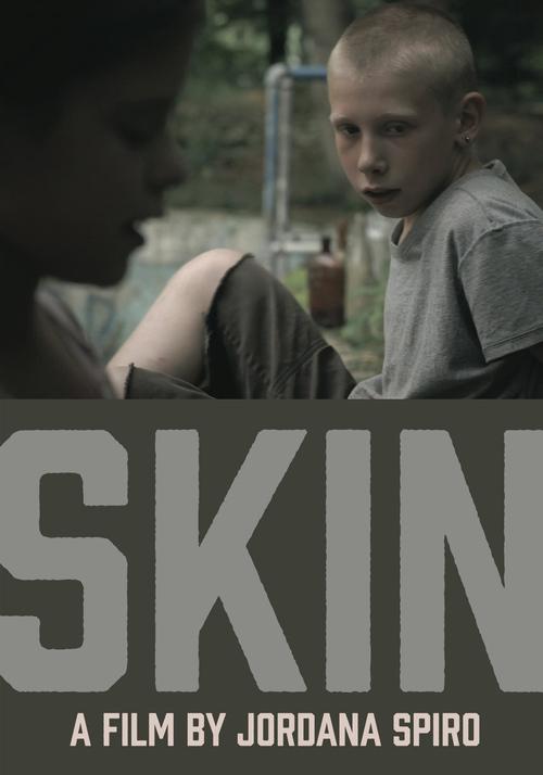 Skin (2012)